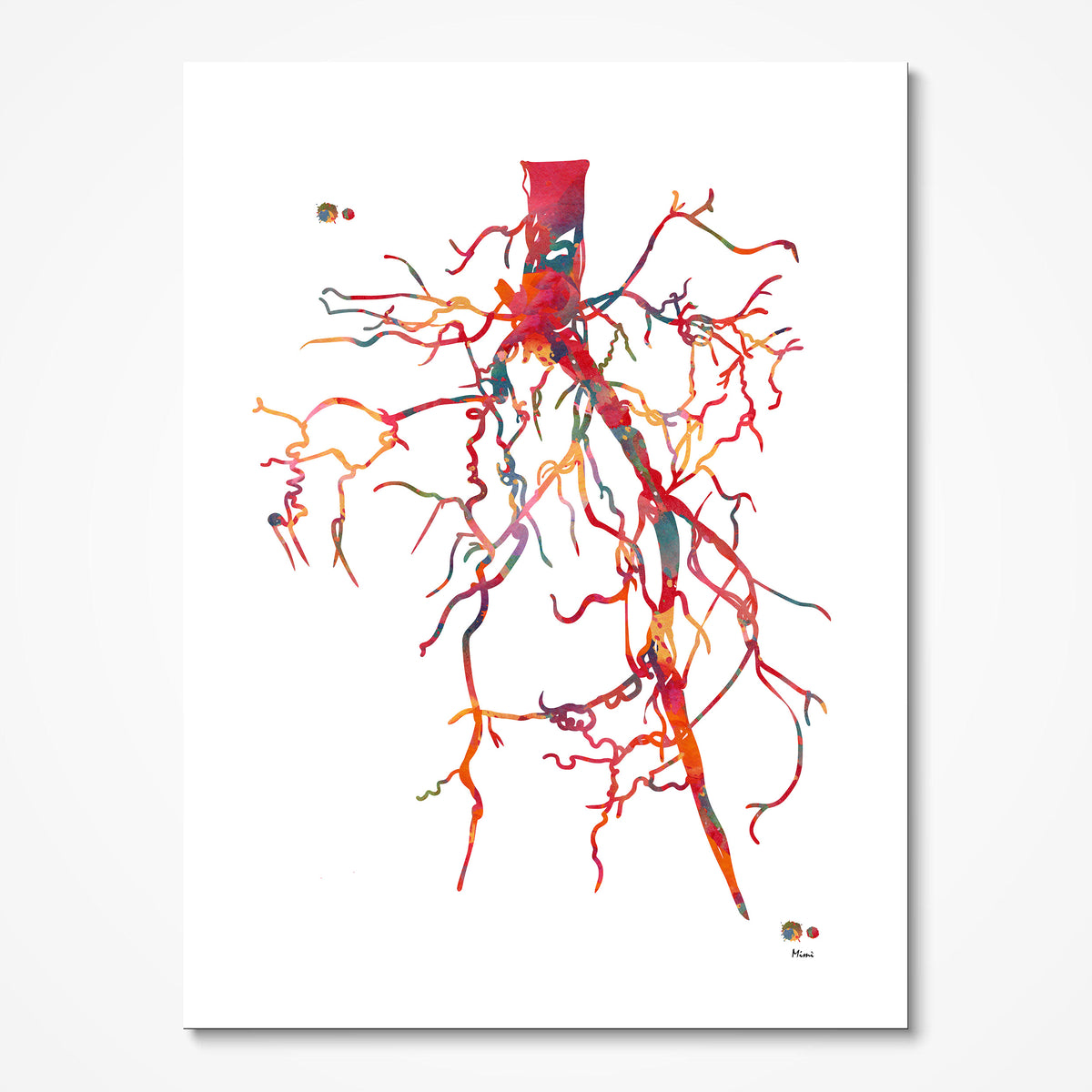 Aorta Angiogram Print Medical Art Angiology | MimiPrints Anatomy Art ...